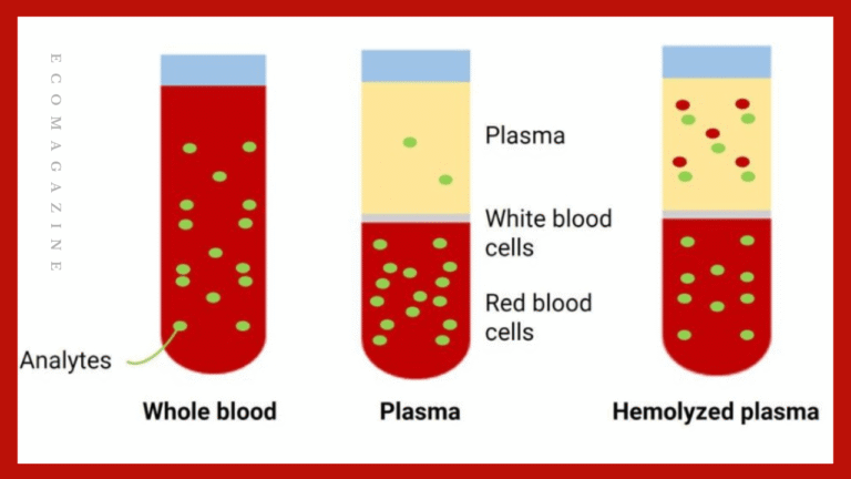 Blood Samples Skew