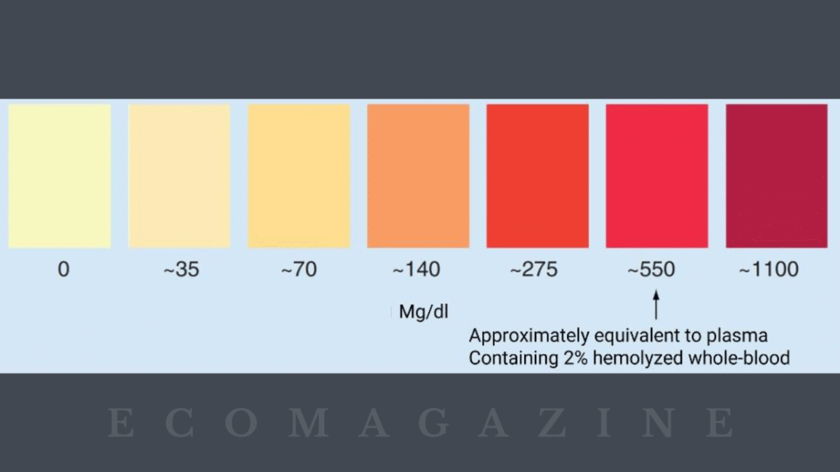 Why Hemolyzed Blood Samples Skew Laboratory Results