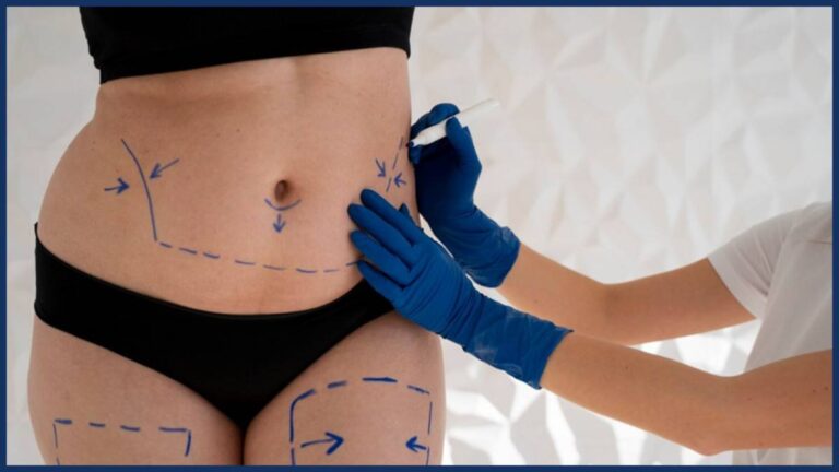 How Thigh Reduction Works with Body Contouring in Manchester Body Contouring in Manchester