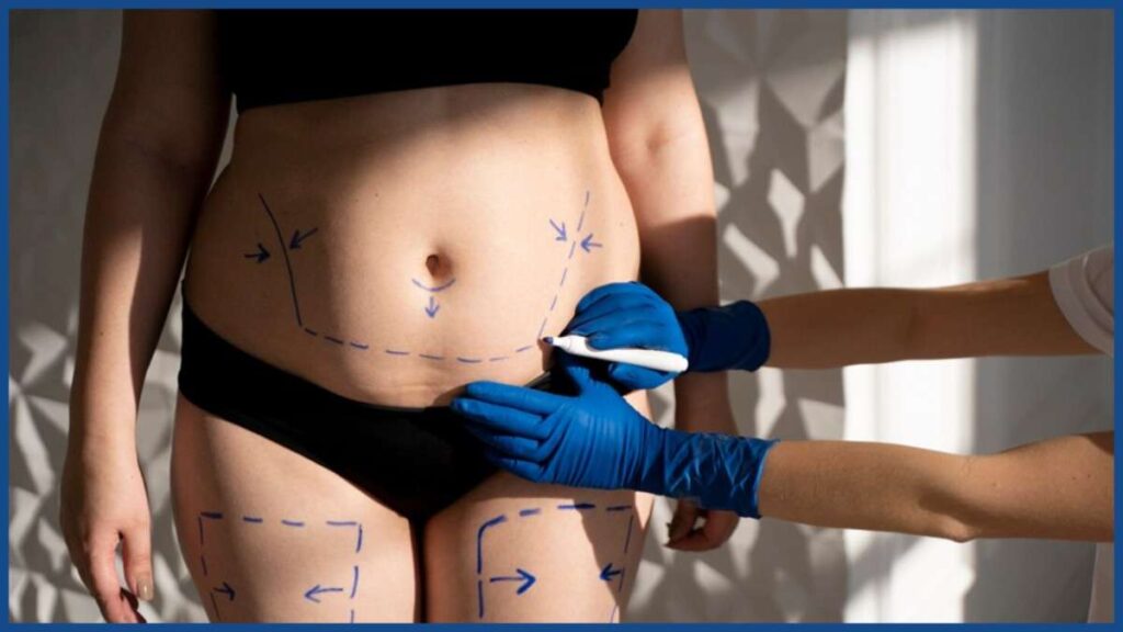 How Thigh Reduction Fits into Body Contouring in Manchester