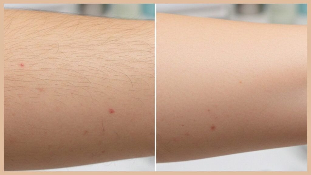 Temporary methods cost less