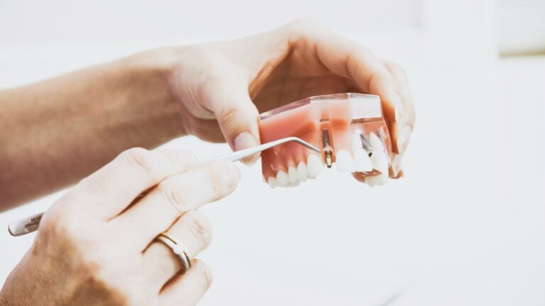 Unlocking the Benefits of Dental Implants in Bowral: A Comprehensive Guide Dental Implants in Bowral