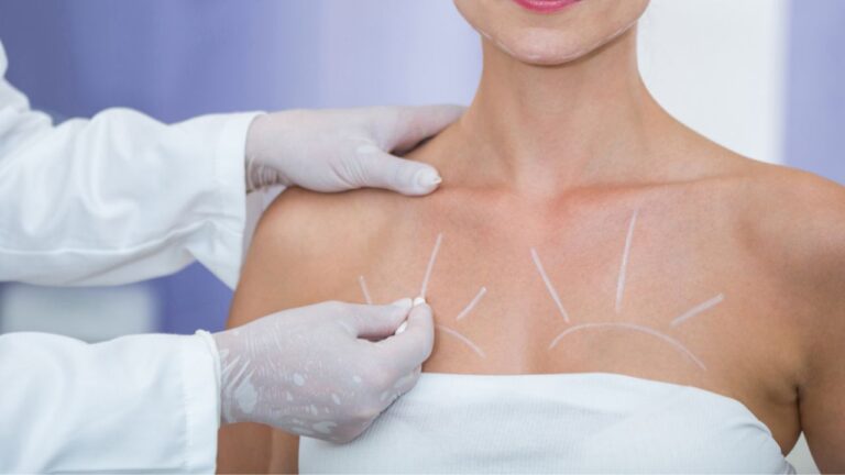 Benefits of Breast Augmentation